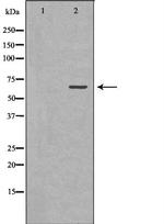 GAD65 Antibody in Western Blot (WB)