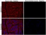 Galectin 9 Antibody