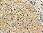 Galectin 9 Antibody in Immunohistochemistry (Paraffin) (IHC (P))