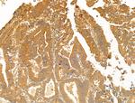 GCHFR Antibody in Immunohistochemistry (Paraffin) (IHC (P))