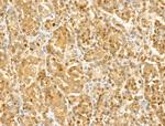 GCHFR Antibody in Immunohistochemistry (Paraffin) (IHC (P))