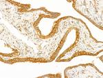 GCHFR Antibody in Immunohistochemistry (Paraffin) (IHC (P))