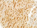 GCHFR Antibody in Immunohistochemistry (Paraffin) (IHC (P))