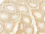 GCHFR Antibody in Immunohistochemistry (Paraffin) (IHC (P))