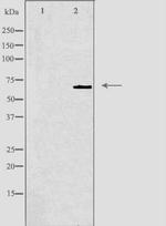 GCKR Antibody in Western Blot (WB)