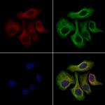 CXCL6 Antibody in Immunocytochemistry (ICC/IF)