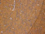 CXCL6 Antibody in Immunohistochemistry (Paraffin) (IHC (P))