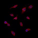 Gelsolin Antibody in Immunocytochemistry (ICC/IF)