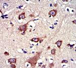 Gelsolin Antibody in Immunohistochemistry (Paraffin) (IHC (P))