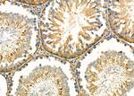 GLO1 Antibody in Immunohistochemistry (Paraffin) (IHC (P))