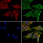 GLS2 Antibody in Immunocytochemistry (ICC/IF)