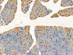 GLS2 Antibody in Immunohistochemistry (Paraffin) (IHC (P))