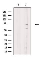 GLS2 Antibody in Western Blot (WB)