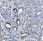 GRIK1 Antibody in Immunohistochemistry (Paraffin) (IHC (P))