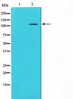 GRIK1 Antibody in Western Blot (WB)