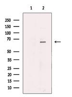 SLC2A12 Antibody in Western Blot (WB)