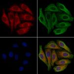 GNAS Antibody in Immunocytochemistry (ICC/IF)