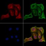 GPAT2 Antibody in Immunocytochemistry (ICC/IF)