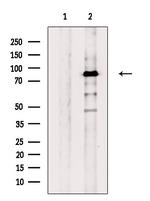 GPAT2 Antibody in Western Blot (WB)