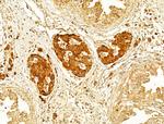 GZMB/GZMH Antibody in Immunohistochemistry (Paraffin) (IHC (P))