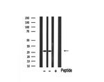 GZMB/GZMH Antibody in Western Blot (WB)