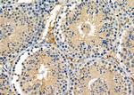 GRID2 Antibody in Immunohistochemistry (Paraffin) (IHC (P))