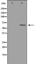 GRK1 Antibody in Western Blot (WB)