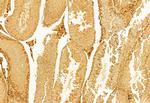 CXCL1 Antibody in Immunohistochemistry (Paraffin) (IHC (P))