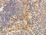 CXCL1 Antibody in Immunohistochemistry (Paraffin) (IHC (P))