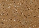 HSPA9 Antibody in Immunohistochemistry (Paraffin) (IHC (P))