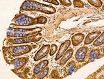 HSPA9 Antibody in Immunohistochemistry (Paraffin) (IHC (P))