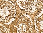 HSPA9 Antibody in Immunohistochemistry (Paraffin) (IHC (P))