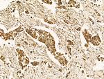 HSPA9 Antibody in Immunohistochemistry (Paraffin) (IHC (P))