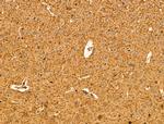 HSPA9 Antibody in Immunohistochemistry (Paraffin) (IHC (P))