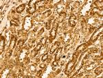 HSPA9 Antibody in Immunohistochemistry (Paraffin) (IHC (P))