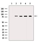 HSPA9 Antibody in Western Blot (WB)