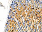 GSTT1 Antibody in Immunohistochemistry (Paraffin) (IHC (P))