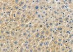 GTPBP1 Antibody in Immunohistochemistry (Paraffin) (IHC (P))