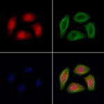 TNRC6A Antibody in Immunocytochemistry (ICC/IF)