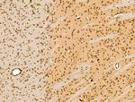 TNRC6A Antibody in Immunohistochemistry (Paraffin) (IHC (P))