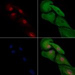 HAND2 Antibody in Immunocytochemistry (ICC/IF)