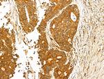 USH1C Antibody in Immunohistochemistry (Paraffin) (IHC (P))