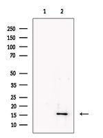 HBB Antibody in Western Blot (WB)