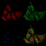 ErbB2 (HER-2) Antibody in Immunocytochemistry (ICC/IF)