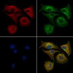 ErbB2 (HER-2) Antibody in Immunocytochemistry (ICC/IF)