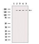 ErbB2 (HER-2) Antibody in Western Blot (WB)