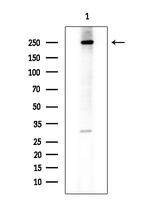 ErbB2 (HER-2) Antibody in Western Blot (WB)