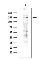 ErbB2 (HER-2) Antibody in Western Blot (WB)