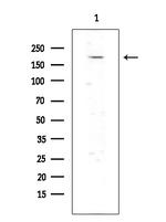 ErbB2 (HER-2) Antibody in Western Blot (WB)