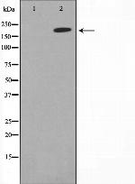 ErbB2 (HER-2) Antibody in Western Blot (WB)